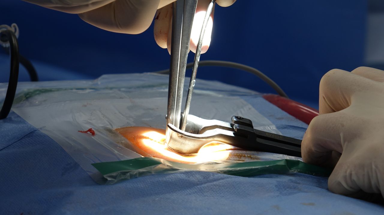 Detailed view of a spinal surgery in a hospital operating room focusing on surgical tools.