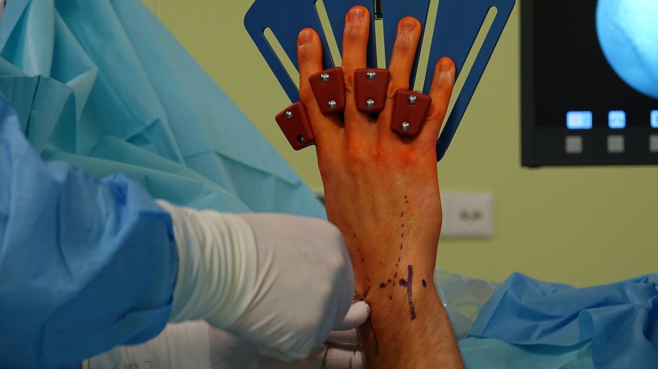 Home Detail of a hand surgery in an operating room with medical tools.